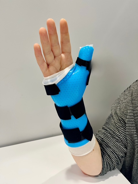 Hand Therapy Experts