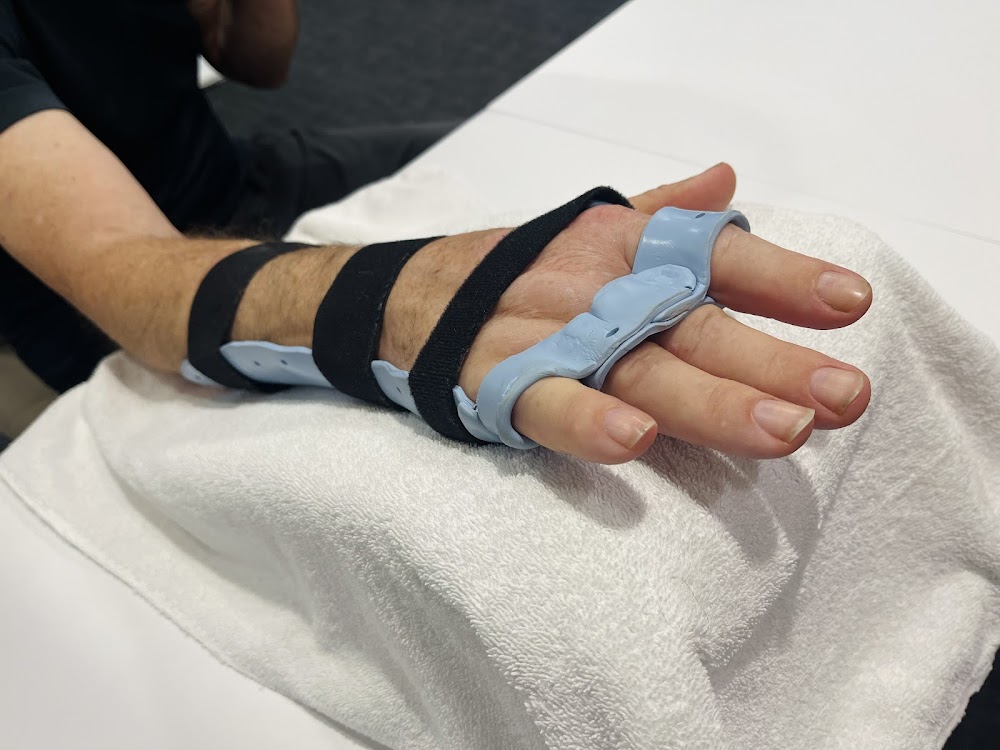 Hand Therapy Experts