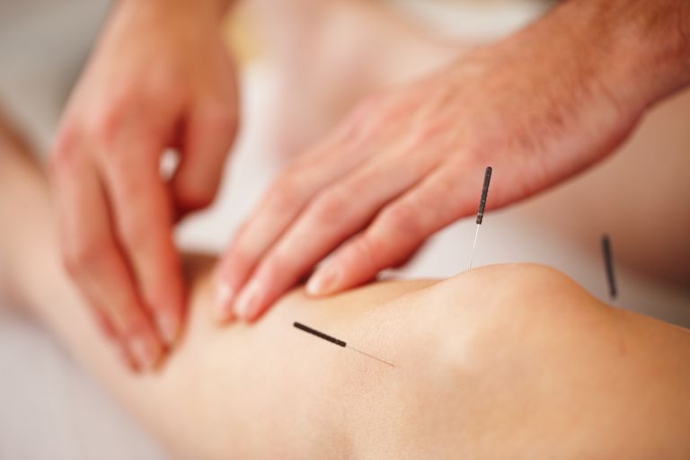 ExL Physiotherapy & Sports Rehab